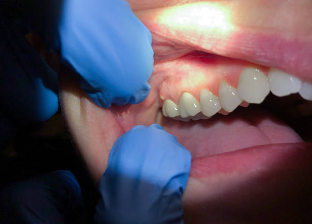 Best Pediatric Emergency Dentist in Cooper, TX